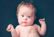 Tennessee elimina las restricciones al aborto de niños con síndrome de Down
