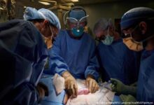 Médicos trasplantan con éxito un riñón de cerdo a un humano