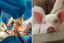 Líderes cristianos dicen que trasplante de corazón de cerdo a humano es «ético»