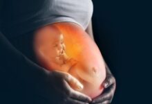 La OMS pide la despenalización total del aborto