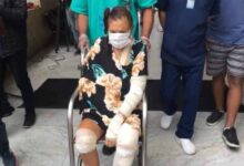 Fue Dios: Anciana sobrevive tras ser arrastrada 400 metros por un vehículo