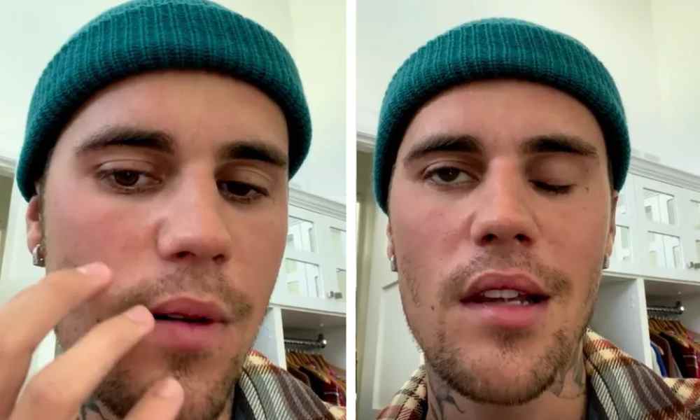 «Confío en Dios», dice Justin Bieber tras revelar que padece parálisis facial