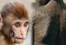OMS: viruela del simio «emergencia mundial» y relacionada con homosexualidad