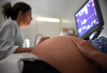 Madre de gemelos renuncia a abortar tras ver a los bebés en ecografía