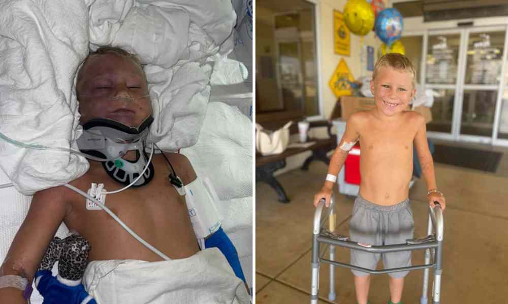 Fue Dios: Niño de 6 años sobrevive tras ser atropellado por tractor