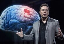 Elon Musk a punto de probar implante de chip en humanos
