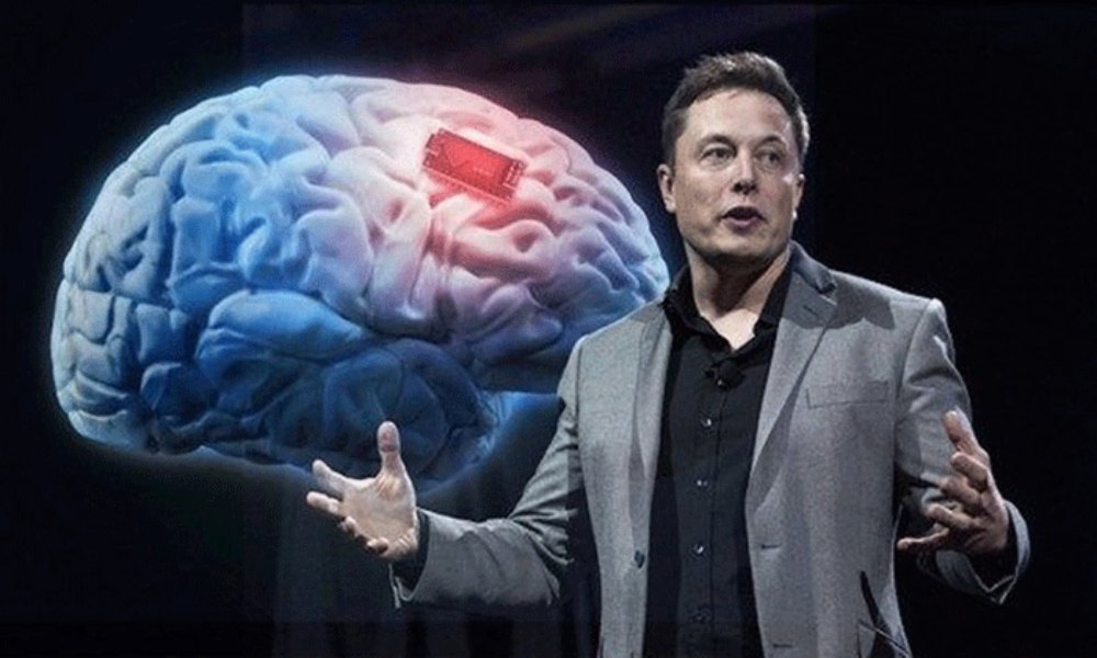 Elon Musk a punto de probar implante de chip en humanos