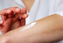 ¿Qué se puede hacer para prevenir el cáncer de piel?