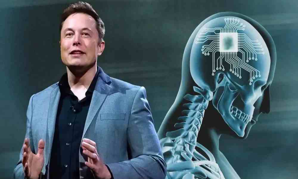 Chip cerebral: Elon Musk obtiene aprobación para comenzar ensayos en humanos