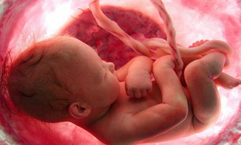 Aborto: principal causa de muerte en todo el mundo en 2023