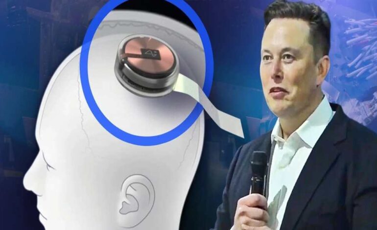 Elon Musk dice que su chip cerebral está funcionando