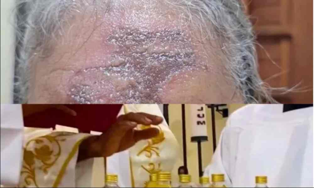 Católicos sufren quemaduras tras ungirse con aceite en misa
